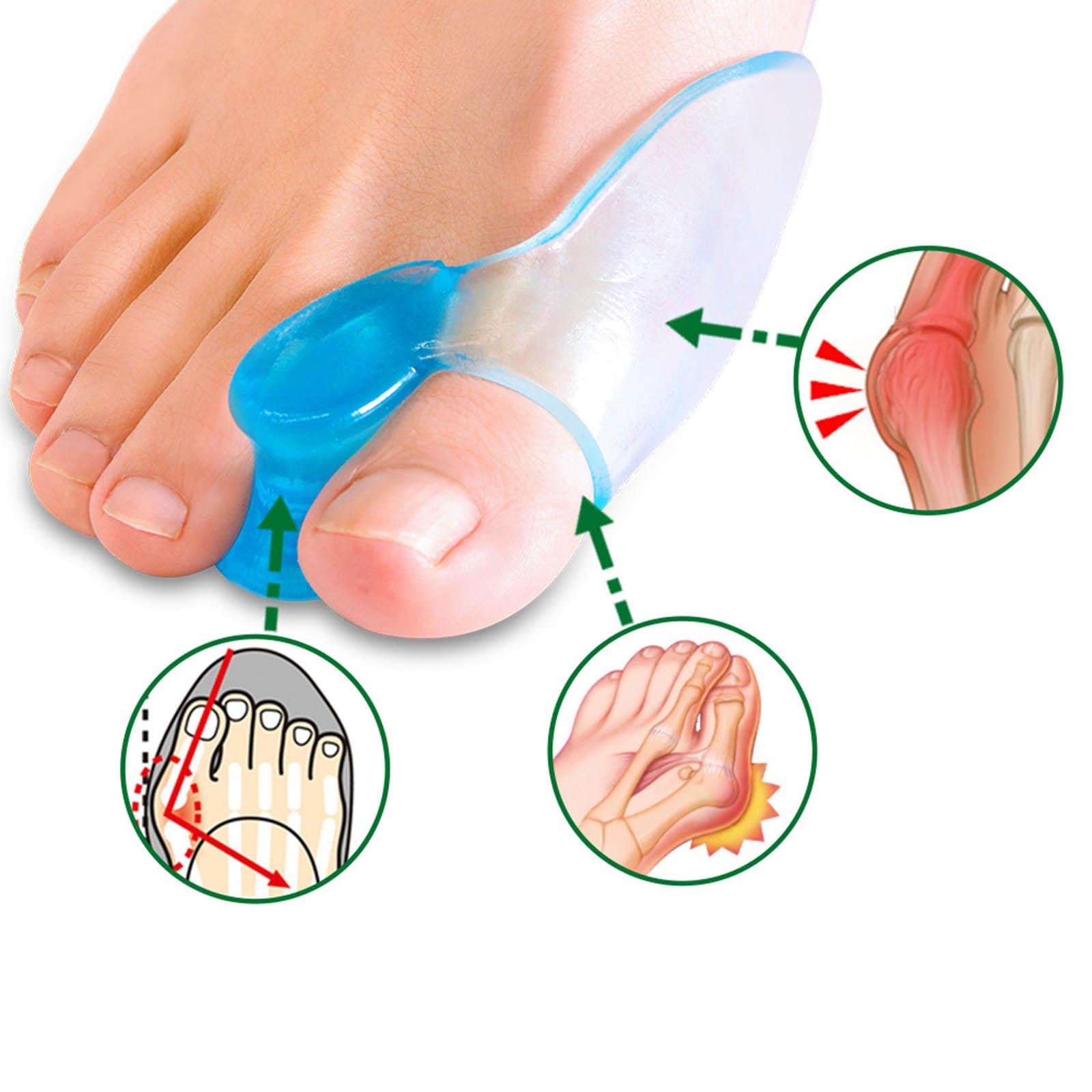Big Toe Bunion Guard Spacer Silicone for Overlapping Toes Crooked Toes