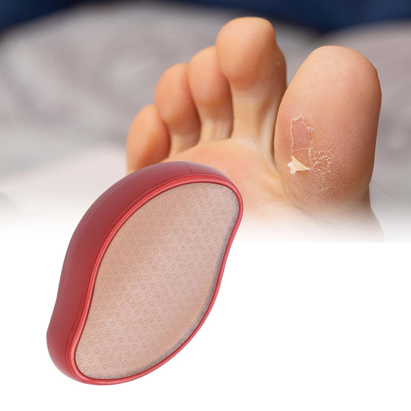 Foot File Callus Remover Foot Scraper for Home Travel Use Red