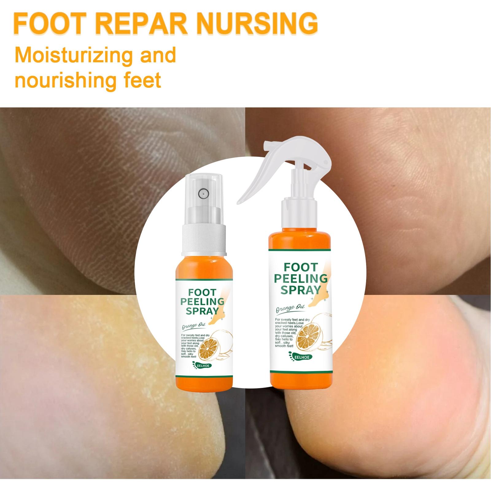 Foot Peeling Spray Hydrating Body Care Moisturzing for Feet Dead Skin  100ml