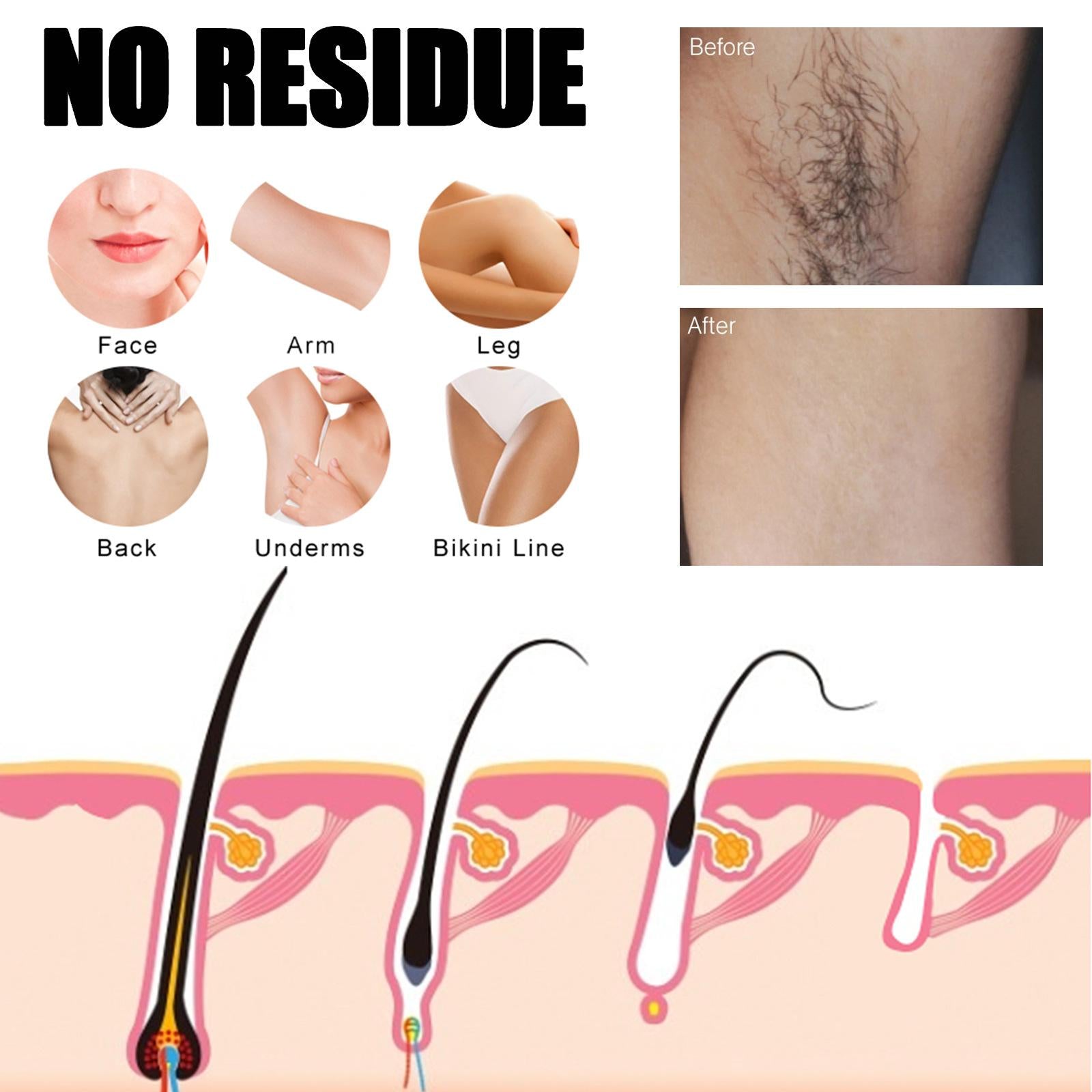 Hair Removal Spray 50ml Hair Inhibiting for Body Bikini Areas Arms For Men
