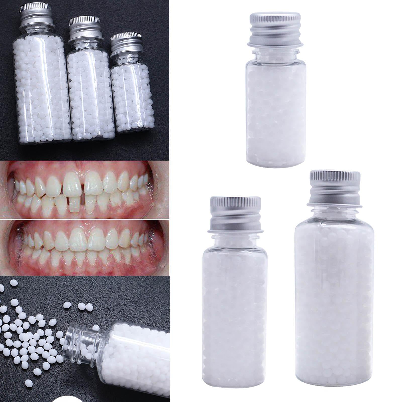 Thermal Beads Teeth Veneers Moldable for Broken Teeth Uneven Teeth 10g