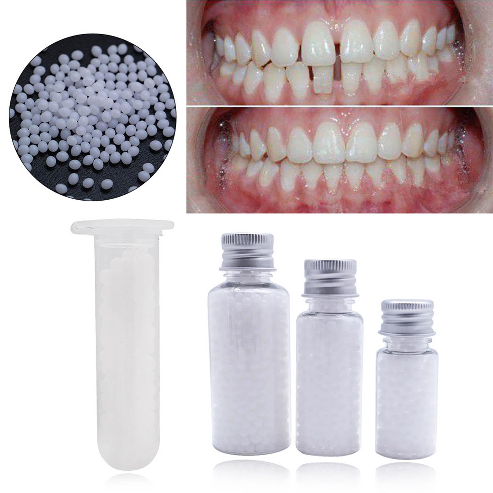 Thermal Beads Teeth Veneers Moldable for Broken Teeth Uneven Teeth 30g