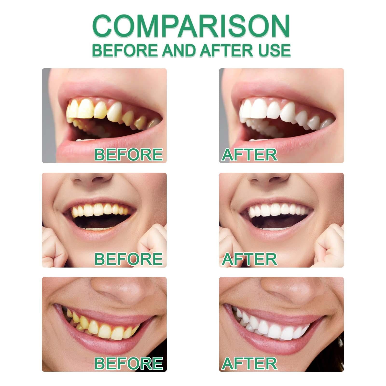 Organic 50G Teeth Whitening Powder Brightening Oral Cleaning Oral Care