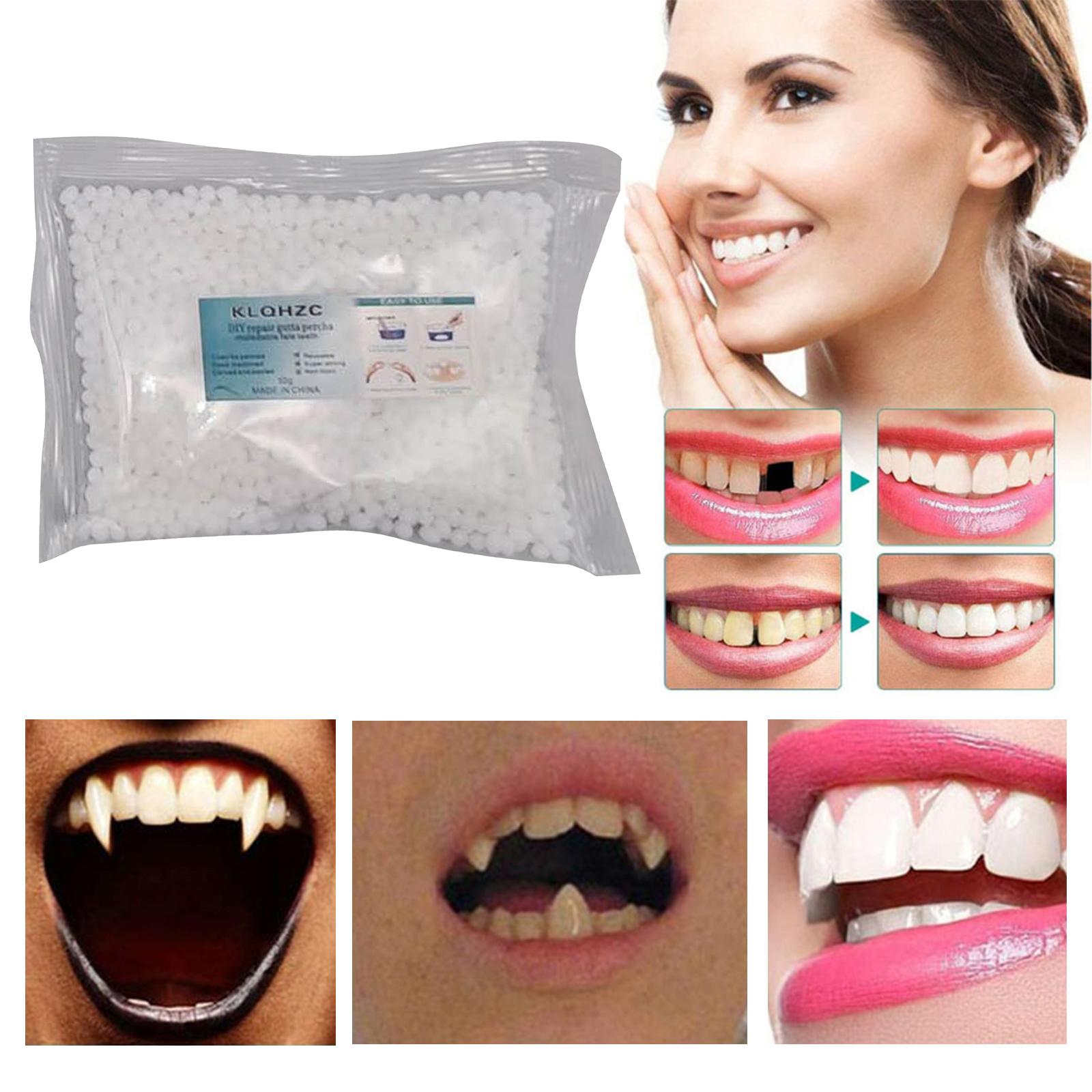 Temporary Tooth Repair Kit Fix The Missing Tooth Teaching Easy to Use Safe