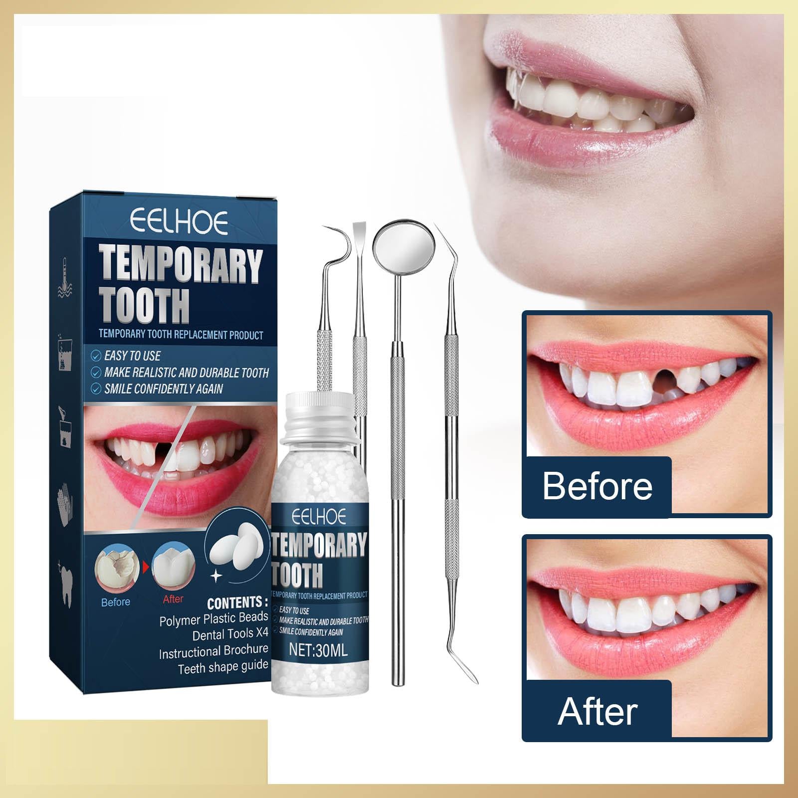 Temporary Tooth Repair Kit with Mouth Mirror for Teeth for Family Home Use