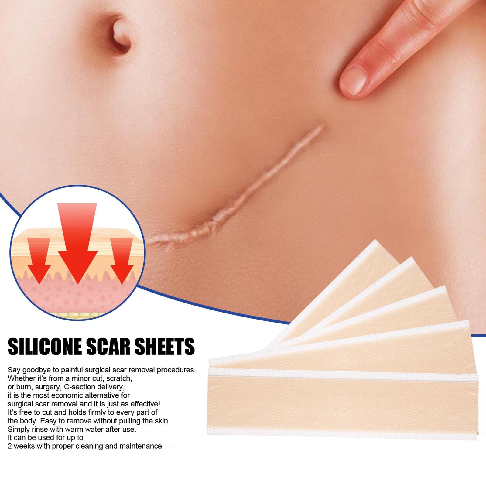 4x Silicone Scar Sheets Strips for Tummy Tuck C Section New and Old Scars 4x15cm