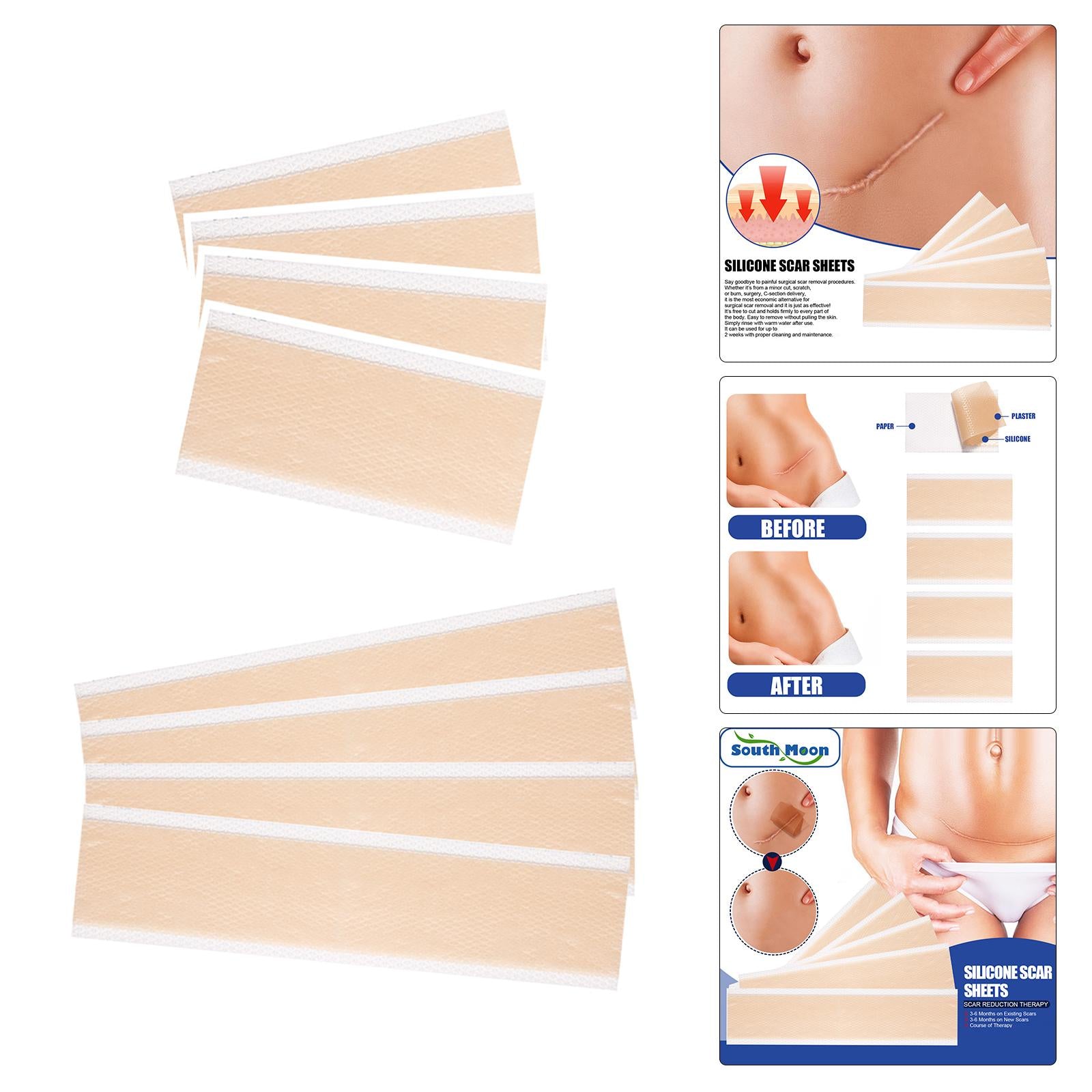4x Silicone Scar Sheets Strips for Tummy Tuck C Section New and Old Scars 4x15cm