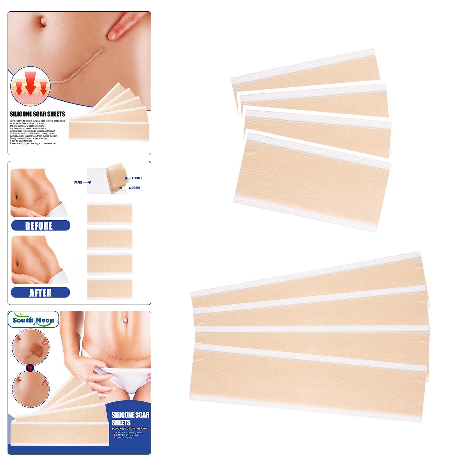 4x Silicone Scar Sheets Strips for Tummy Tuck C Section New and Old Scars 4x15cm