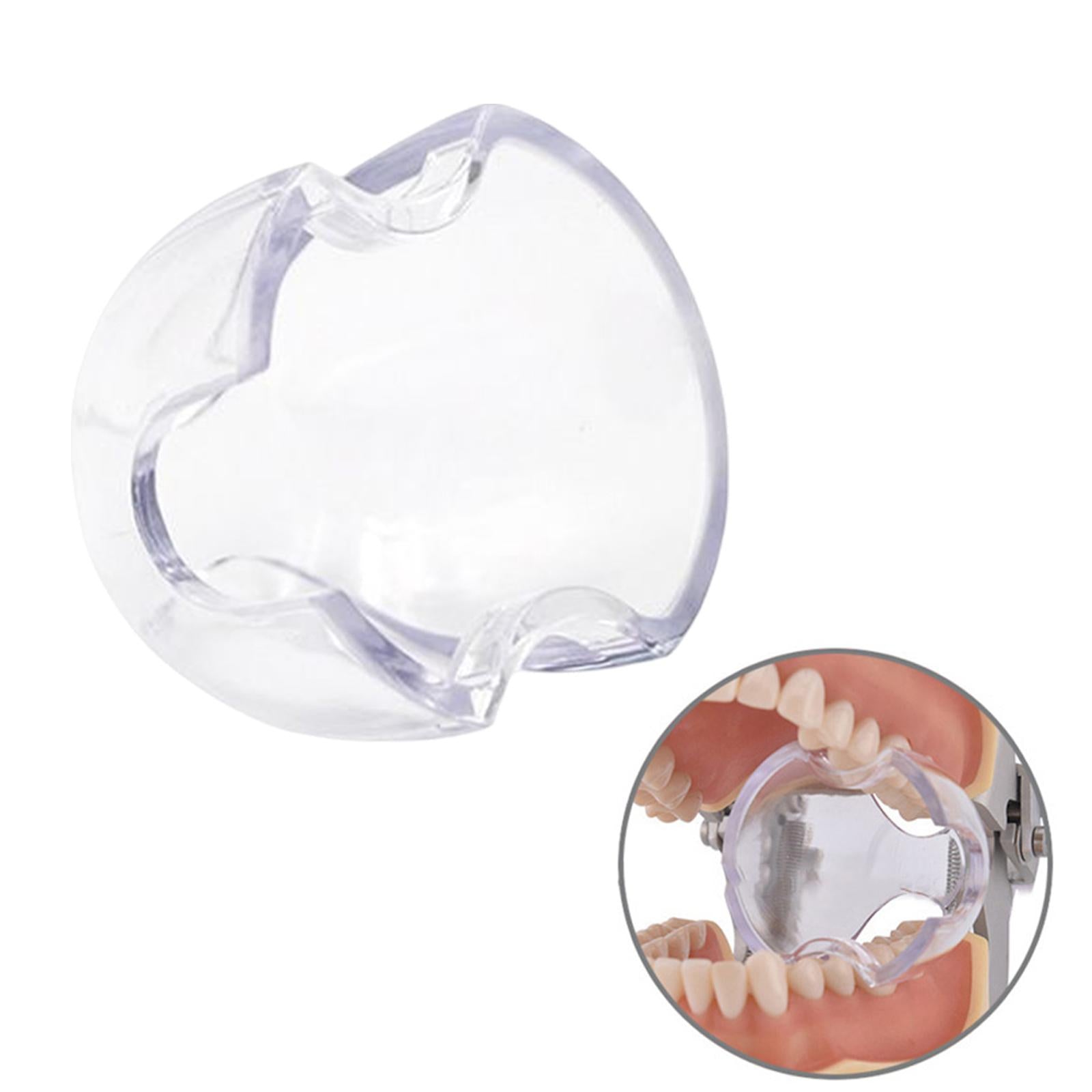 Teeth Whitening Cheek Retractor BPA Free for Mouthguard Game Posterior Clear