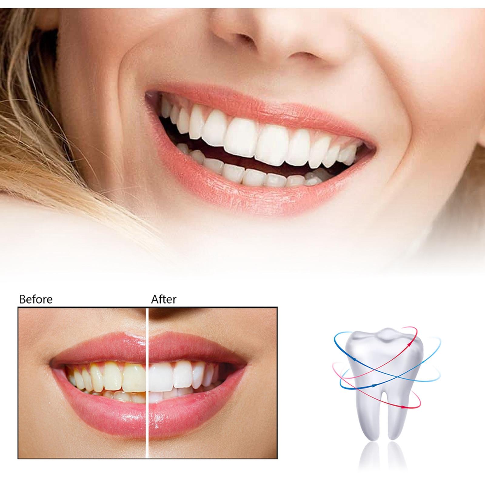 Teeth Whitening Pen 3ml 0.1 fl oz Stain Remover Non Sensitive Oral Tool 2Pcs