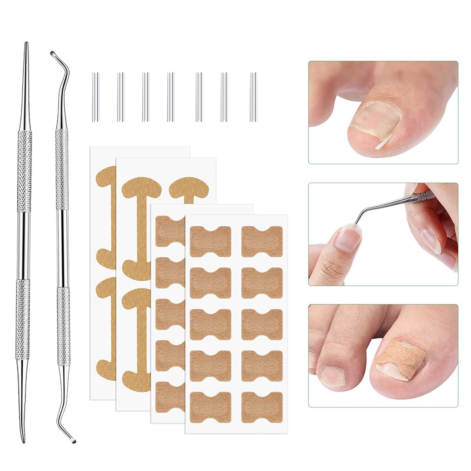 Ingrown Toenail Corrector Stickers Toenail Patch for Foot Care Sticker