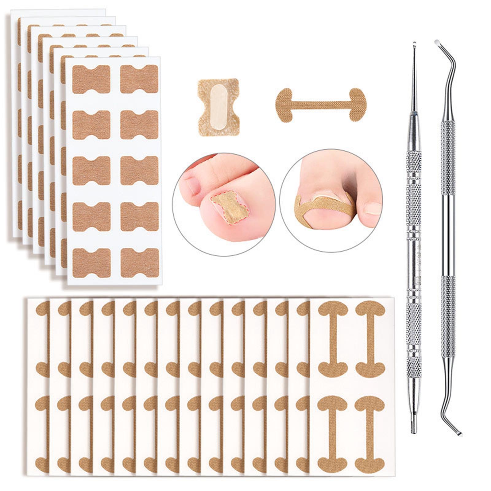 Ingrown Toenail Corrector Stickers Toenail Patch for Foot Care Sticker
