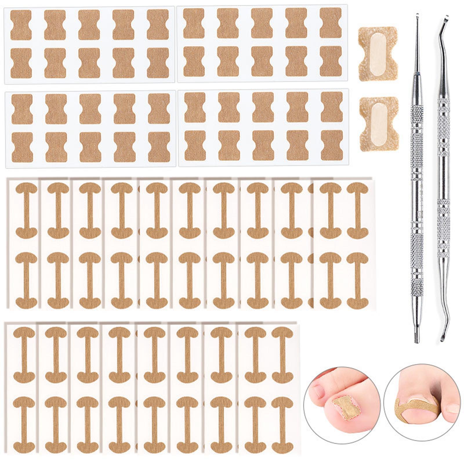 Ingrown Toenail Corrector Stickers Toenail Patch for Foot Care Sticker