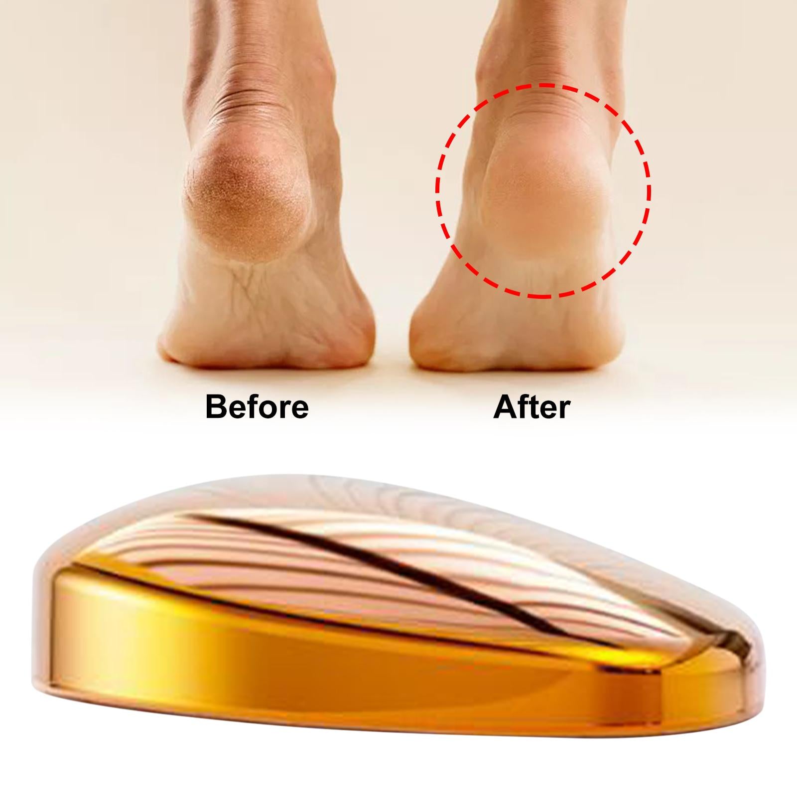 Manual Foot Callus Remover Feet Files for Dead Hard Skin Men Women Yellow