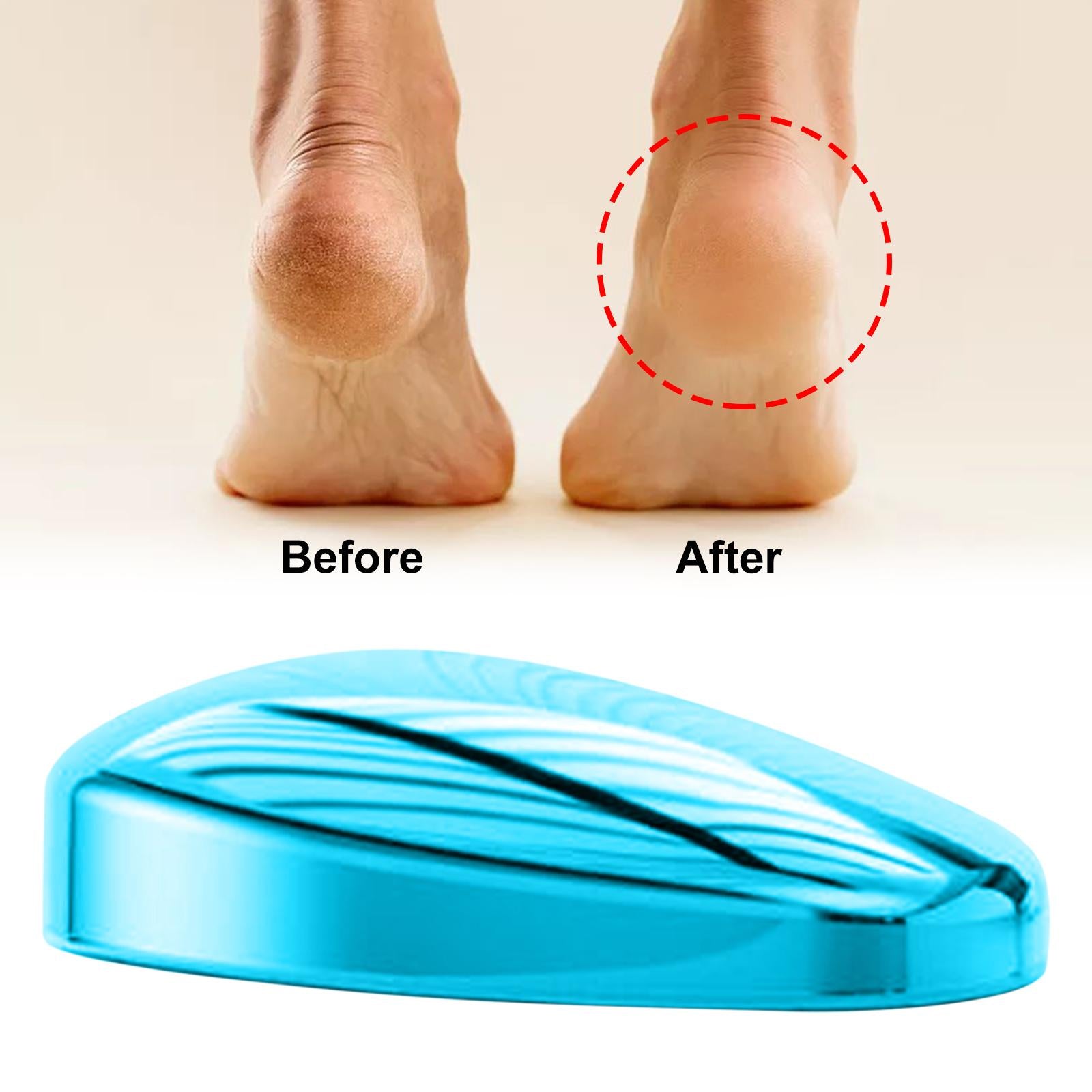 Manual Foot Callus Remover Feet Files for Dead Hard Skin Men Women Blue