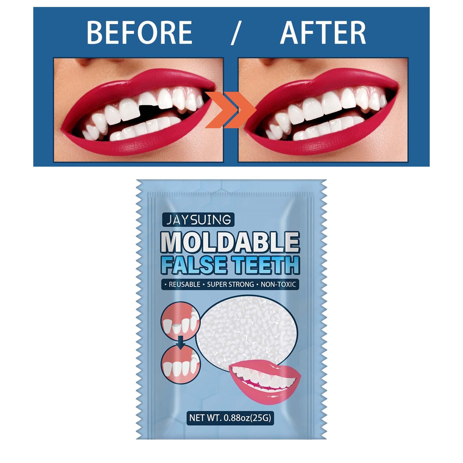 25G Temporary Tooth Repair Kit Teeth Gaps Falseteeth for Teeth Veneer Broken