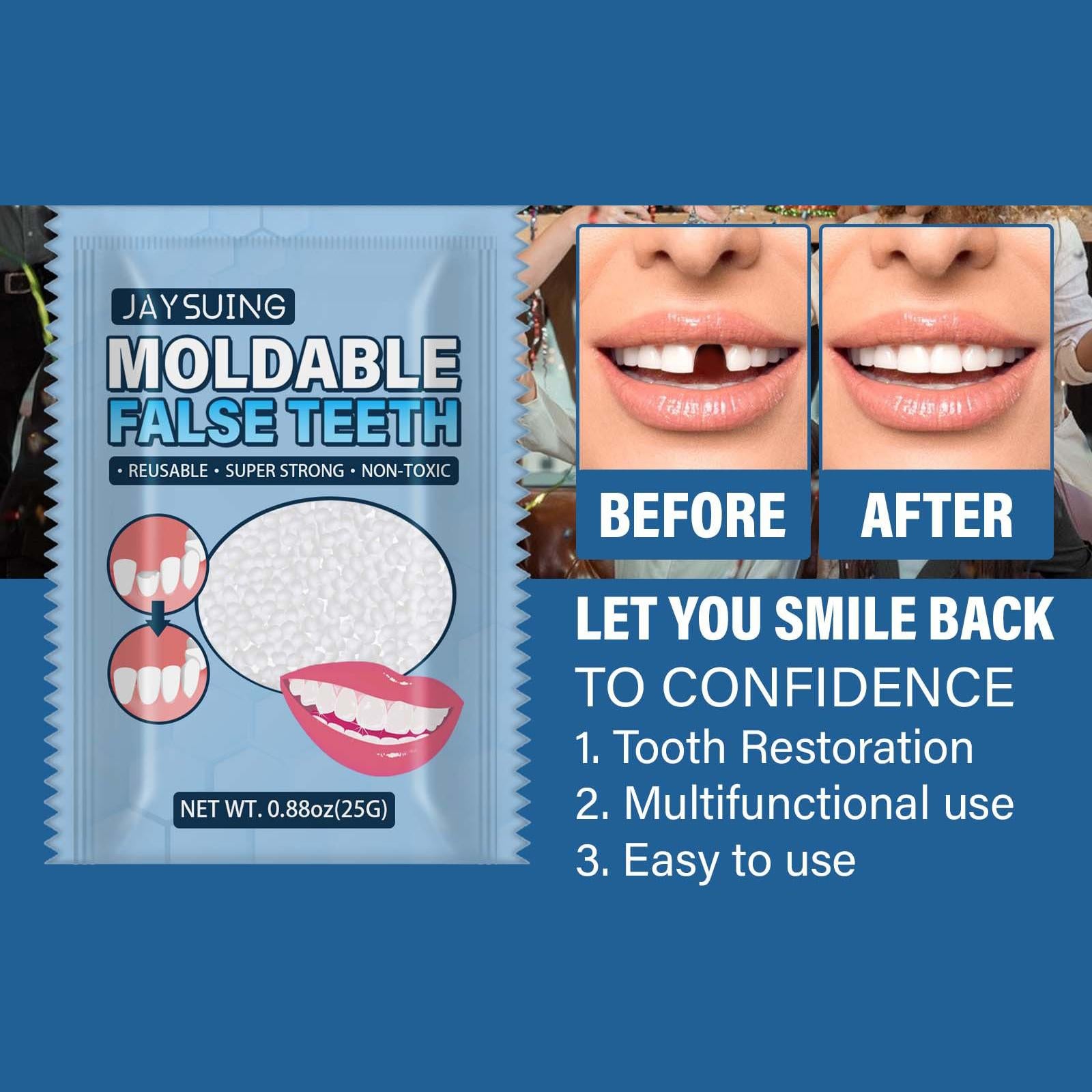 25G Temporary Tooth Repair Kit Teeth Gaps Falseteeth for Teeth Veneer Broken