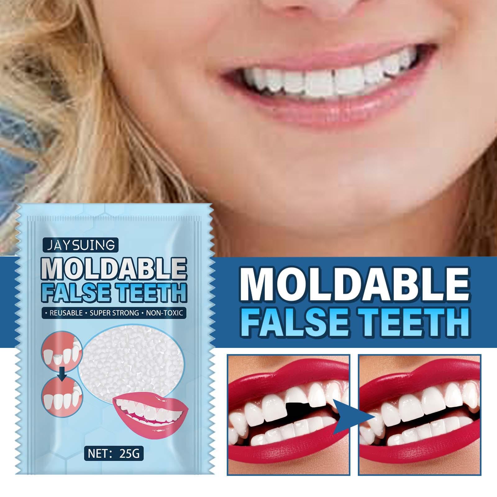 25G Temporary Tooth Repair Kit Teeth Gaps Falseteeth for Teeth Veneer Broken