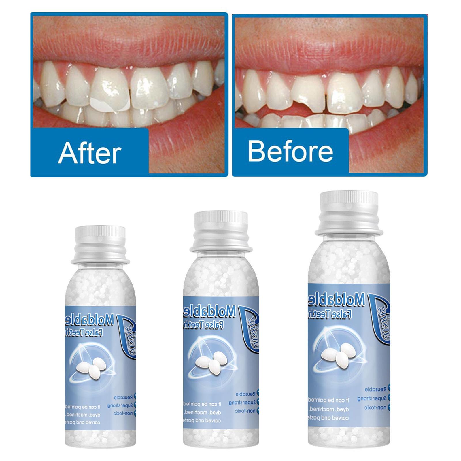 Temporary Tooth Repair Kit Denture Adhesive Teeth Gaps for Broken Big Gaps 10ml