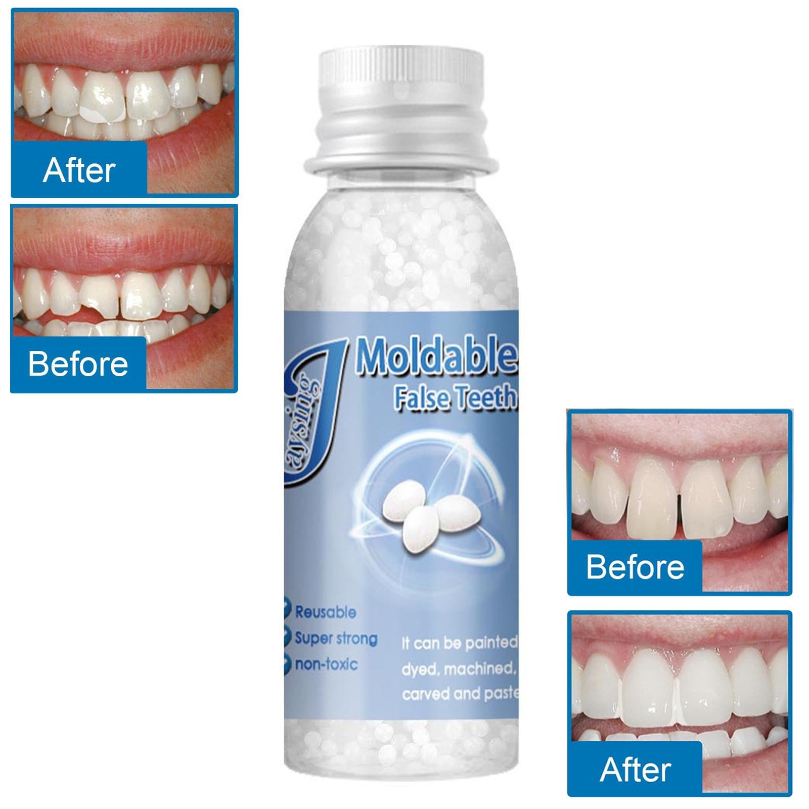 Temporary Tooth Repair Kit Denture Adhesive Teeth Gaps for Broken Big Gaps 30ml