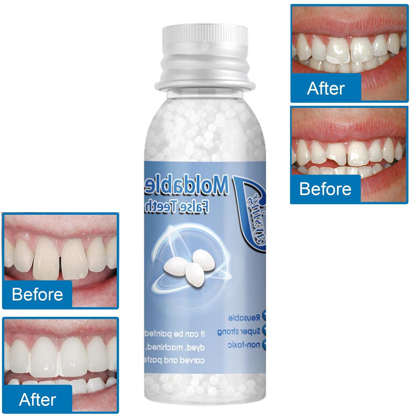 Temporary Tooth Repair Kit Denture Adhesive Teeth Gaps for Broken Big Gaps 30ml