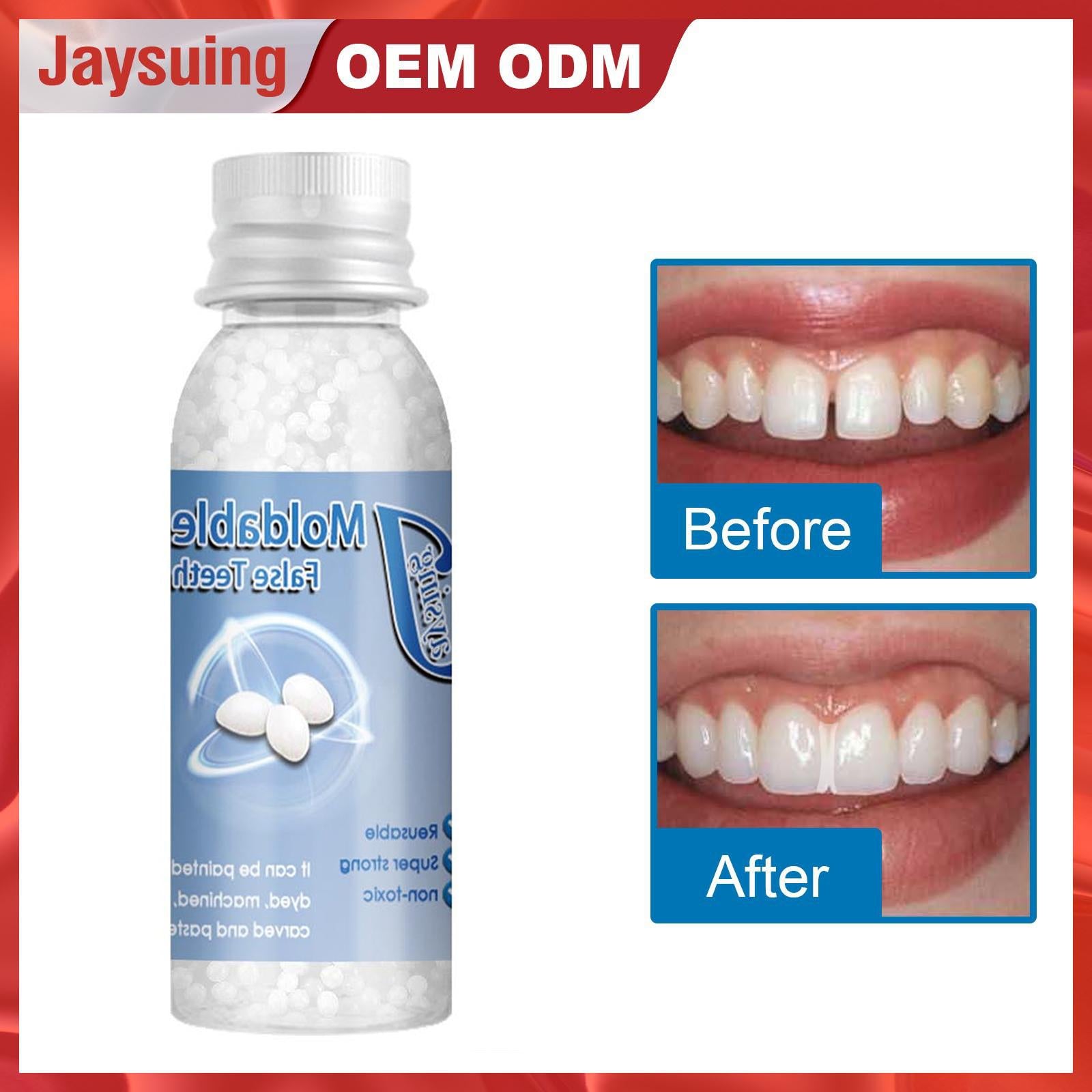 Temporary Tooth Repair Kit Denture Adhesive Teeth Gaps for Broken Big Gaps 30ml