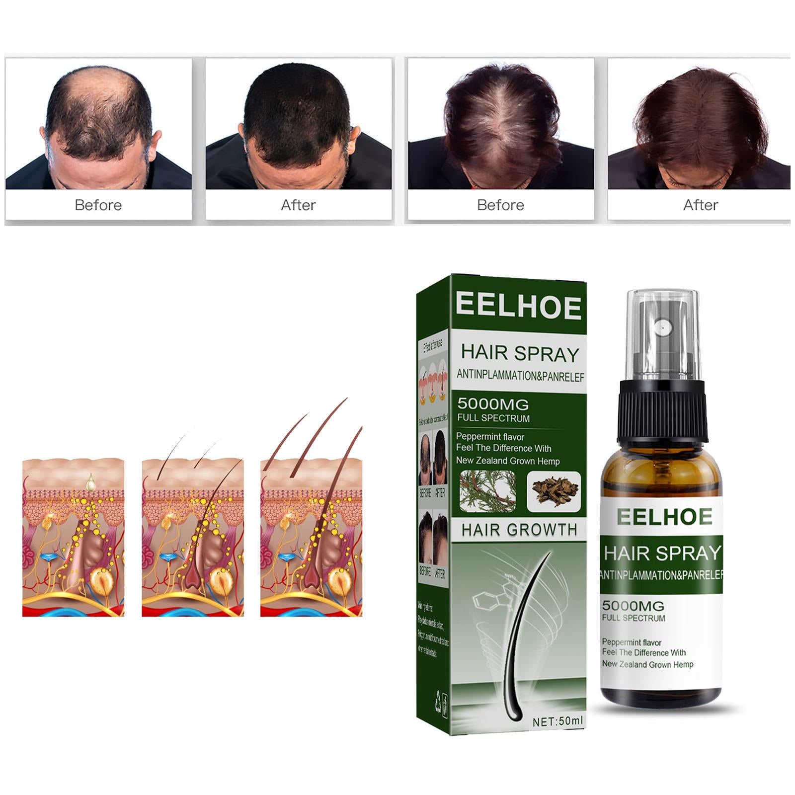 50ml Hair Growth Spray for Thinning Different Hair Types