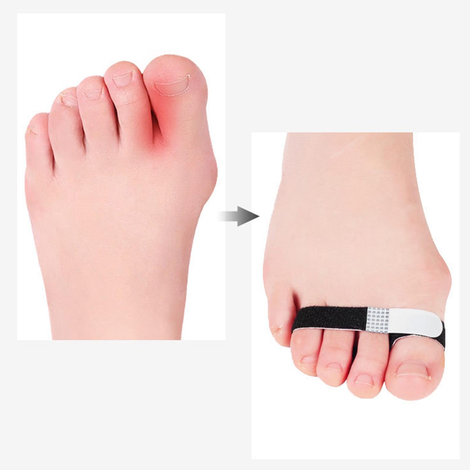 4x Hammer Toe Wraps Toe Straighteners Elasticity Cushioned Bandages for Men