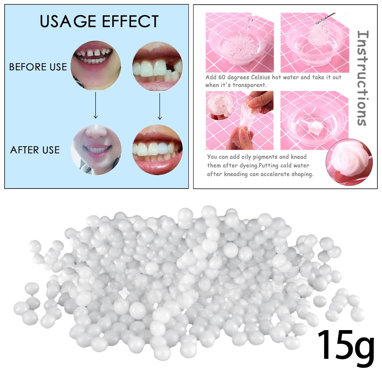 Temporary Tooth Repair Kit Restoration of Missing and Broken Teeth