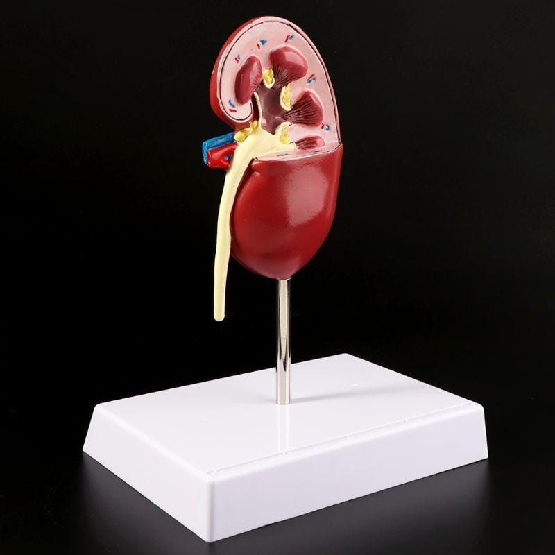 Nephropathy Model Kidney Pathology Nephrolithiasis Urology Communication Model Teaching Supplies