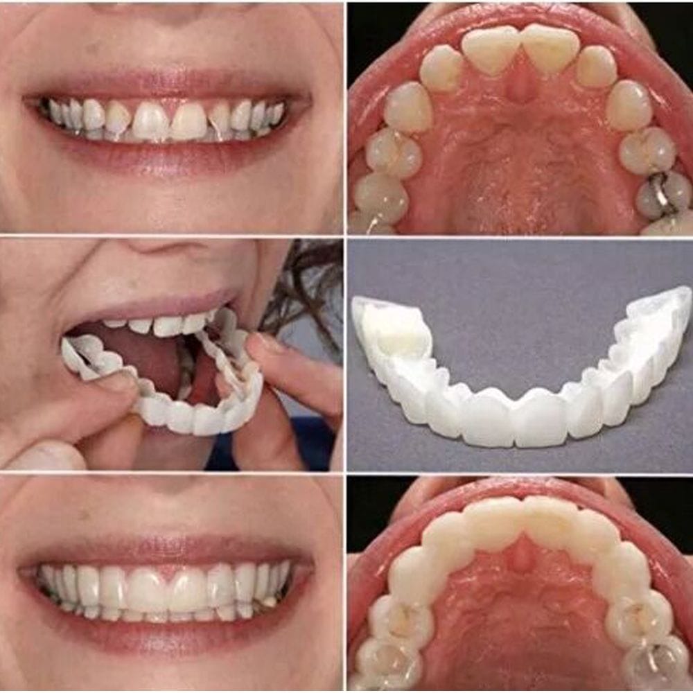 Teeth Whitening Perfect Instant Smile Comfortable Cosmetic