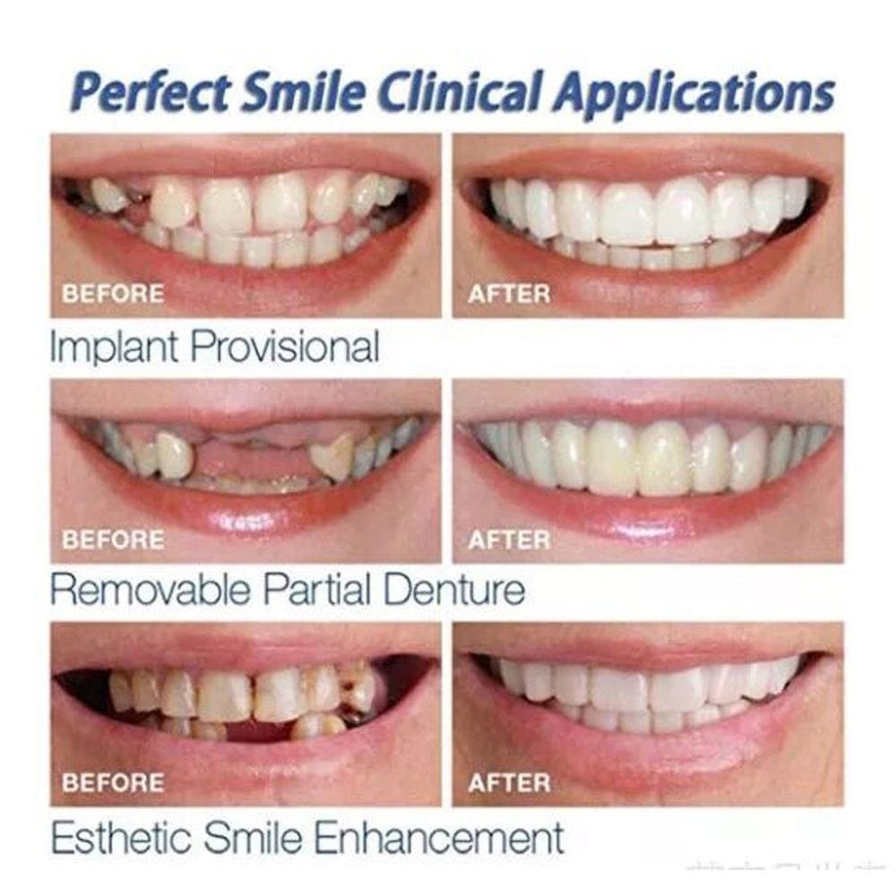 Teeth Whitening Perfect Instant Smile Comfortable Cosmetic